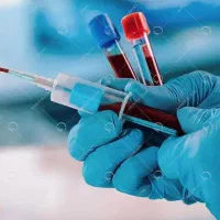 پذیرش و خونگیری ازمایشات در منزل
