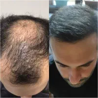 از ریزش تا رویش یک مسیر تخصصی