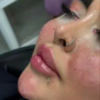 خدمات امبدینگ، پرسینگ،ژل،بوتاکس،هیپ دیپ باسن تخفیف