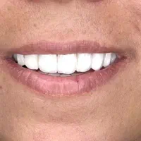 دستیار دندانپزشکی حرفه ای