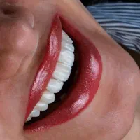 جشنواره نوروز کامپوزیت لمینت روکش عصب ترمیم