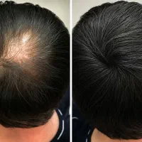 دیکه باید هر هفته بری آرایشکاه