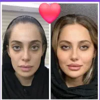 آفر ویژه خدمات زیبایی بوتاکس فیلرو.. کلینیک پزشکی|خدمات آرایشگری و زیبایی|کرج, جهانشهر|دیوار