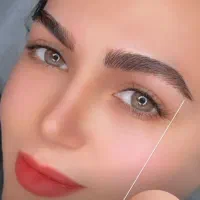 میکرو بلیدینگ فیبروز با ماندگاری بالا بدون درد