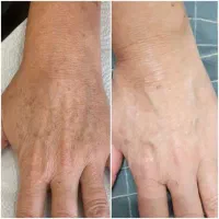 پاک کننده قوی لکّه ص و ر ت