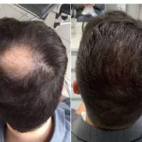 اقدام نکنی بدترم میشه