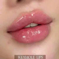 ژل و بوتاکس