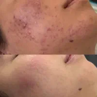 نیازمند مدل برای فشیال