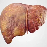 با روشی گیاهی کبد خود را بهبود بده