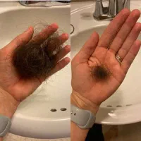از جمع کچل ها دربیا