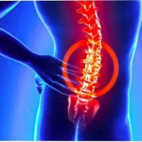 دیسک گردن و کمر اعصاب سیاتیک
