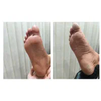 پدیکور تخصصی دیسا