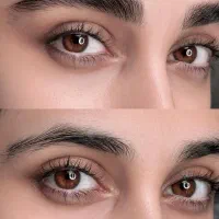 میکروبلیدینگ.شیدینگ لب تتوی بدن