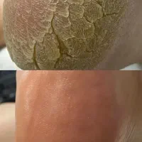 اموزش پدیکور و کفسابی+ مدرک بین الملی معتبر