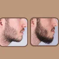 پسری که ریش نداره چیه