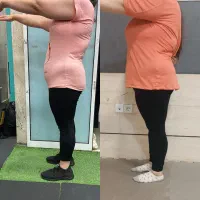 کاهش وزن/لاغری/فرم دهی