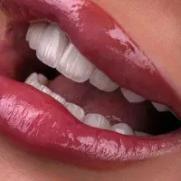 دندانپزشکی/ معاینه رایگان . نقد و اقساط