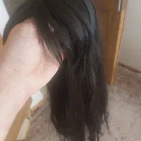 پروتز کامل مو مهتاج گالری
