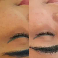 انجام خدمات پاکسازی صورت