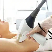 لیزر موهای زائد با تخفیف ویژه