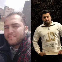 تضمینی موهاتو فول تراکم بکار+پی ار پی مزو بوتاکس