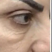 کرم بیوممتیک جوان ساز