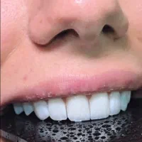 کامپوزیت و لمینیت اقساطی