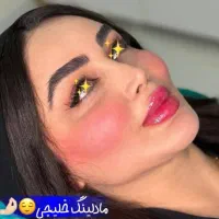 جشنواره بهاره لیفت چشم گربه ای/ژل/فیلر/بوتاکس