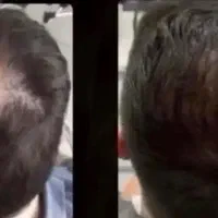 معجون معجزه موی سر