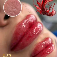 مدل میکروبلیدینگ و میکروپیگمنتیشن