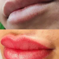 میکرو،شیدینگ ،بن مژه ،ریموو،خط چشم