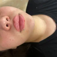 فیلر و‌بوتاکس ،رنگ مو تخصصی ،میکروبلیدینگ