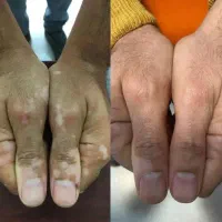 با طب نوین این مشکلات احتمال درمان میره بالا