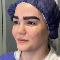 کاشت ابرو،مو، مژه بدون جراحی نقد و اقساط