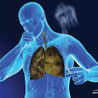 پاکسازی و شستشوی ریه