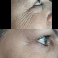 چروک های صورتت بیشتر شده