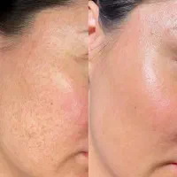وایتکس صورت صابون روشن‌کننده و کرم مرطوب‌کننده