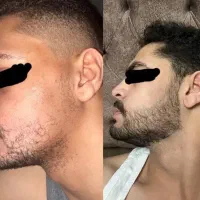 بمب رویش ریش صبح بیدار شوو ببین ریش داری