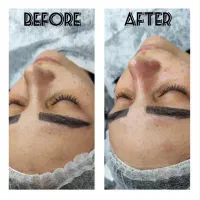 خدمات تخصصی فیشال و پاکسازی پوست و دست