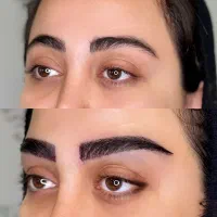 کاشت ابرو