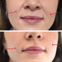 کرم ضد چروک لیفت  و سفید کننده صورت