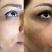کرم معجزه شب اورجینال