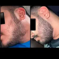 دیگه نمیخواد داشتن ریش و سبیل رو تو خواب ببینی