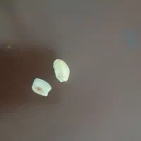 سنگ مهره