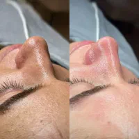 فیشال تخصصی صورت و بدن