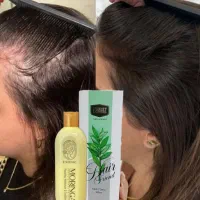 تونیک و شامپو ضد ریزش مو