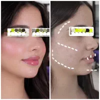 کلینیک زیبایی تزریق فیلر ژل بوتاکس لیزر مزوتراپی