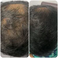 این روغن رو به هرجا بزنی مو درمیاره
