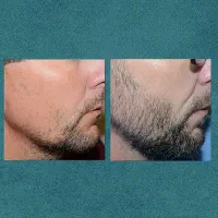 معجزه|آرایشی، بهداشتی، درمانی|خوی, |دیوار