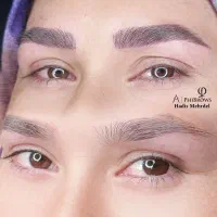 فیبروز ابرو فقط ۱،۹۹۹،۰۰۰